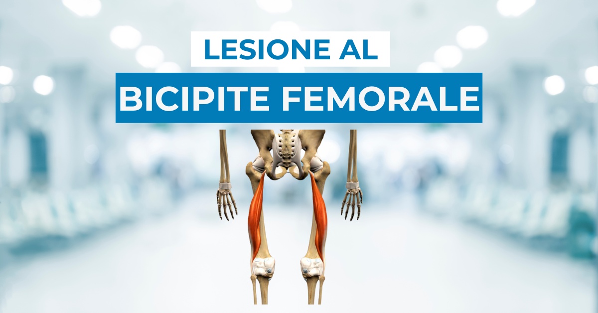 Lesione al bicipite femorale: cos’è, come curarla, tempi di recupero